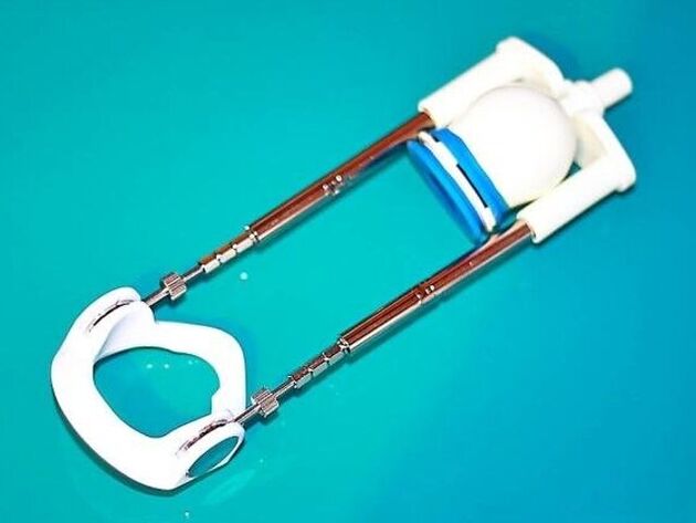 برای افزایش طول فالوس، می توانید از یک دستگاه مخصوص - یک اکستندر استفاده کنید.